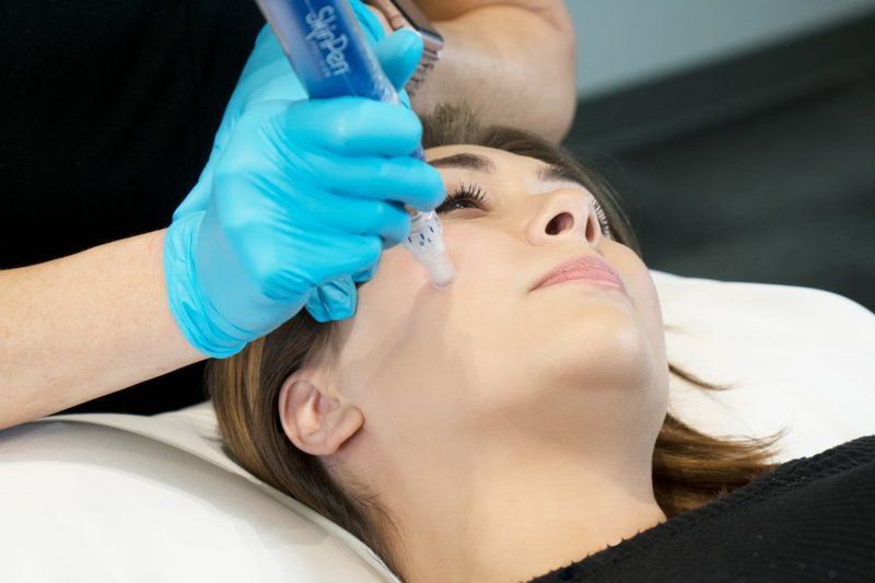 After microneedling course