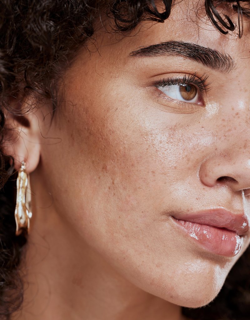 Before — baseline skin texture